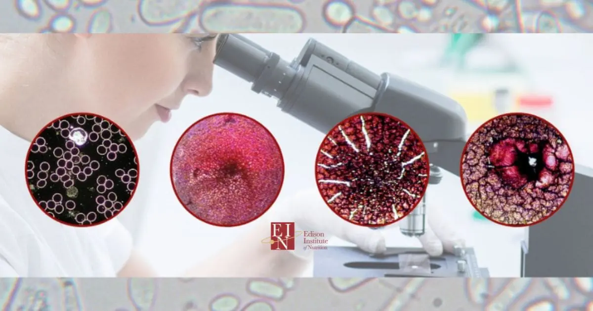 Live Cell Microscopy used as an Assesment Tool for Professional Nutrition Practitioners | Online Nutrition Training Course & Diplomas | Edison Institute of Nutrition is a Nutrition School Training Nutrition Professionals Worldwide