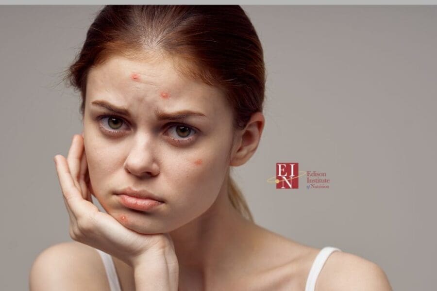 What Your Skin Says About Your Health | Online Nutrition Training Course & Diplomas | Edison Institute of Nutrition is a nutrition school