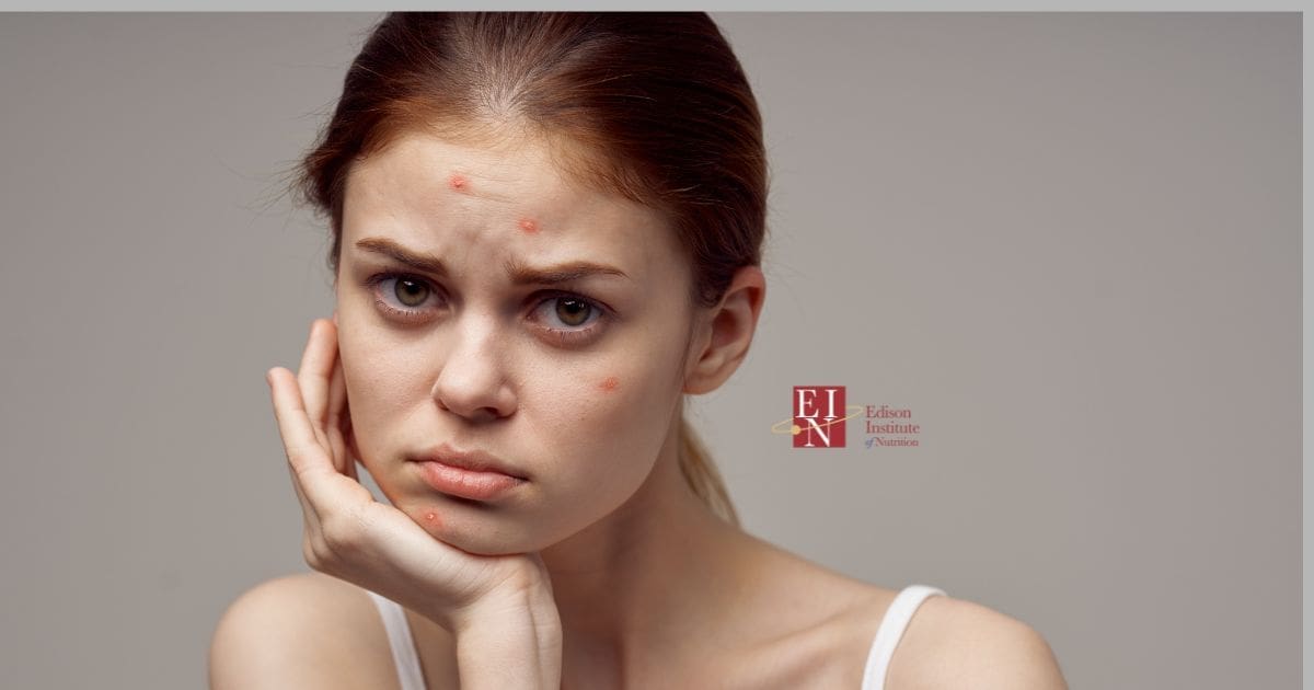 What Your Skin Says About Your Health | Online Nutrition Training Course & Diplomas | Edison Institute of Nutrition