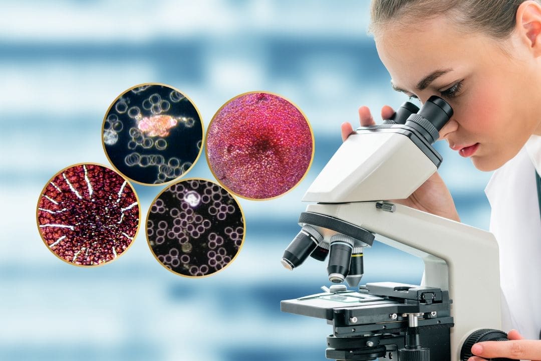 event-lcm-edison-institute-of-nutrition | Live Blood analysis